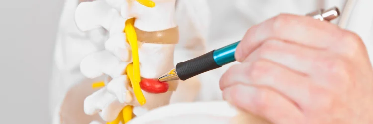 Randolph NJ Chiropractor Discusses Herniated Discs